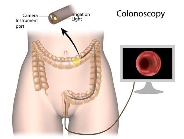 Gummy B. reccomend Causes of anal b leeding