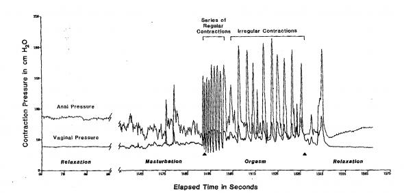 Intensity of orgasm