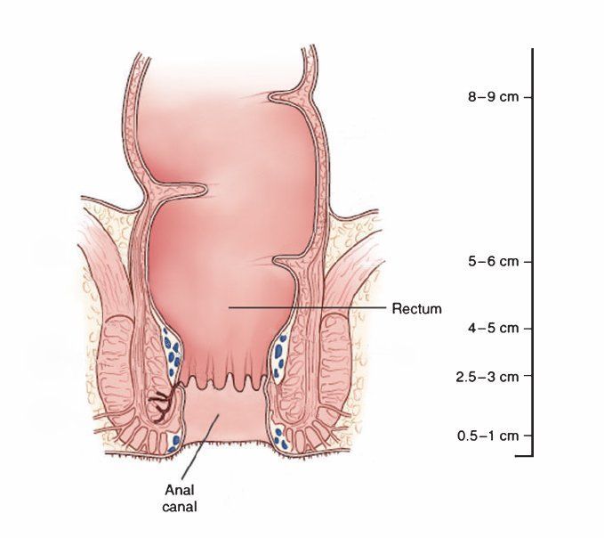 Sex with internal vaginal warts